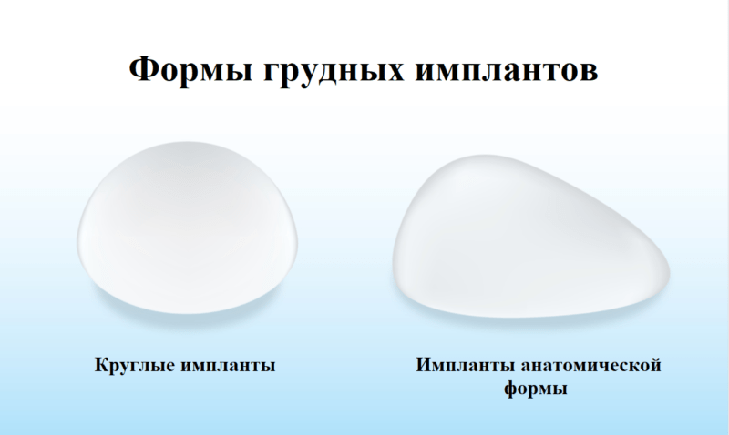 форма имплантата